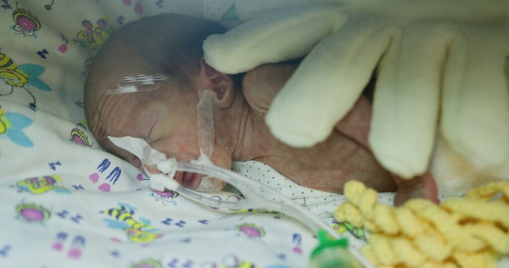 Providing care in the neonatal intensive care unit for infants - HIE